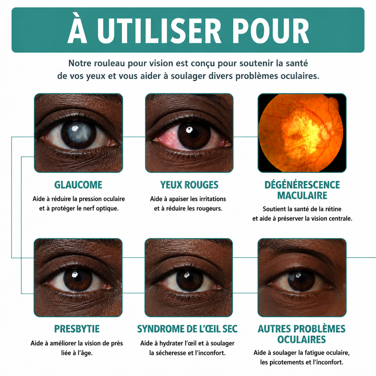 ✅ Rouleau Vision – Retrouvez une vue plus claire