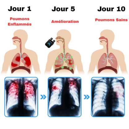 Homtopy Inhalis – Aérosol Respiratoire Détox 100% Naturel