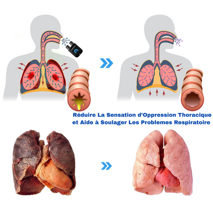 Homtopy Inhalis – Aérosol Respiratoire Détox 100% Naturel