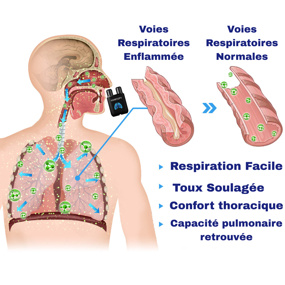 Homtopy Inhalis – Aérosol Respiratoire Détox 100% Naturel